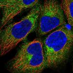 beta-1 Adaptin Antibody in Immunocytochemistry (ICC/IF)