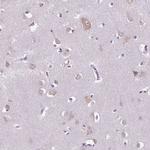 NAALAD2 Antibody in Immunohistochemistry (Paraffin) (IHC (P))