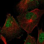 SEMA4F Antibody in Immunocytochemistry (ICC/IF)