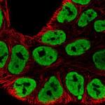 hnRNP A3 Antibody in Immunocytochemistry (ICC/IF)