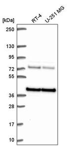 hnRNP A3 Antibody in Western Blot (WB)