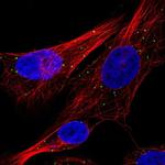 Cathepsin C Antibody in Immunocytochemistry (ICC/IF)