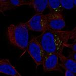 ST8SIA3 Antibody in Immunocytochemistry (ICC/IF)