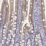 UCN2 Antibody in Immunohistochemistry (IHC)