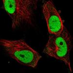 Fra1 Antibody in Immunocytochemistry (ICC/IF)