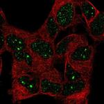 BAZ1B Antibody in Immunocytochemistry (ICC/IF)