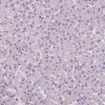 HYDIN Antibody in Immunohistochemistry (Paraffin) (IHC (P))