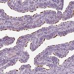 HYDIN Antibody in Immunohistochemistry (IHC)