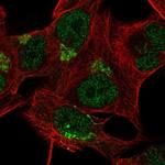 TBC1D14 Antibody in Immunocytochemistry (ICC/IF)