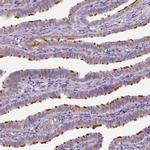 IFT52 Antibody in Immunohistochemistry (IHC)