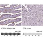 IFT52 Antibody