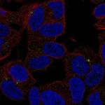 SLC35D3 Antibody in Immunocytochemistry (ICC/IF)