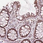 GPS2 Antibody in Immunohistochemistry (IHC)