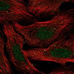 SLC30A3 Antibody in Immunocytochemistry (ICC/IF)