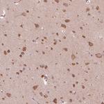 CNOT2 Antibody in Immunohistochemistry (Paraffin) (IHC (P))