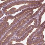 CNOT2 Antibody in Immunohistochemistry (Paraffin) (IHC (P))