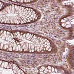 CNOT2 Antibody in Immunohistochemistry (Paraffin) (IHC (P))