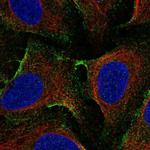 EHD1 Antibody in Immunocytochemistry (ICC/IF)