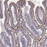 SLC22A18 Antibody in Immunohistochemistry (IHC)