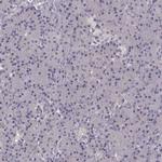 SLC22A18 Antibody in Immunohistochemistry (IHC)