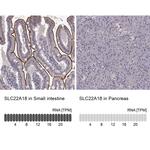 SLC22A18 Antibody