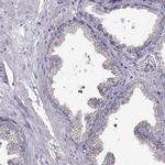 STMND1 Antibody in Immunohistochemistry (IHC)