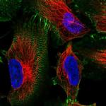 MACF1 Antibody in Immunocytochemistry (ICC/IF)