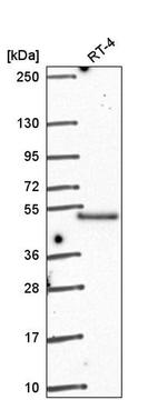 GRINL1A Antibody in Western Blot (WB)