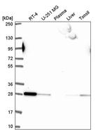 RAB5B Antibody in Western Blot (WB)