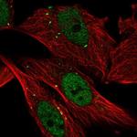 Cathepsin C Antibody in Immunocytochemistry (ICC/IF)