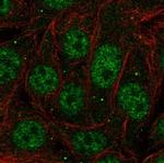 PCBP1 Antibody in Immunocytochemistry (ICC/IF)