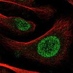 POT1 Antibody in Immunocytochemistry (ICC/IF)