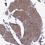 SYNPO2 Antibody in Immunohistochemistry (IHC)