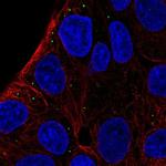 ST3GAL5 Antibody in Immunocytochemistry (ICC/IF)