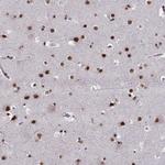 LUC7L Antibody in Immunohistochemistry (Paraffin) (IHC (P))