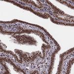 LUC7L Antibody in Immunohistochemistry (Paraffin) (IHC (P))