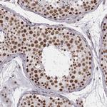 LUC7L Antibody in Immunohistochemistry (Paraffin) (IHC (P))