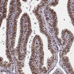 LUC7L Antibody in Immunohistochemistry (IHC)