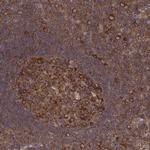 CAD Antibody in Immunohistochemistry (IHC)