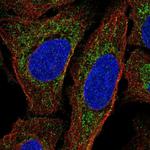 MTERF Antibody in Immunocytochemistry (ICC/IF)