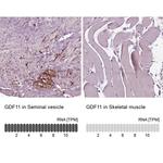 GDF11 Antibody