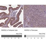 WARS2 Antibody