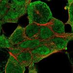 NSD1 Antibody in Immunocytochemistry (ICC/IF)