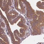 ARAP1 Antibody in Immunohistochemistry (Paraffin) (IHC (P))