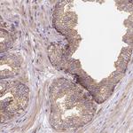 ARAP1 Antibody in Immunohistochemistry (Paraffin) (IHC (P))