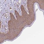 ARAP1 Antibody in Immunohistochemistry (Paraffin) (IHC (P))