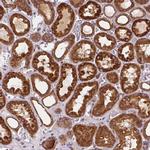 ARAP1 Antibody in Immunohistochemistry (IHC)