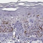 Cyclin F Antibody in Immunohistochemistry (IHC)