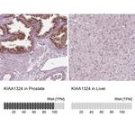 KIAA1324 Antibody in Immunohistochemistry (IHC)