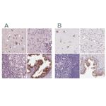 KIAA1324 Antibody in Immunohistochemistry (IHC)